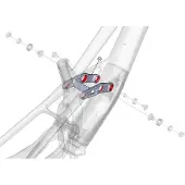 Lapierre Spicy T Shock Link Clair